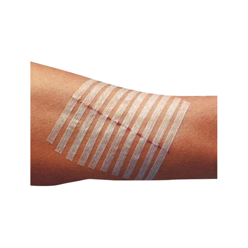 Steri-Strip