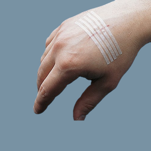 Steri-Strip