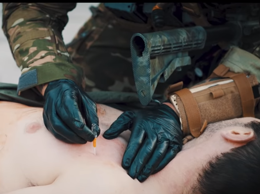 Ars For Needle Decompression
